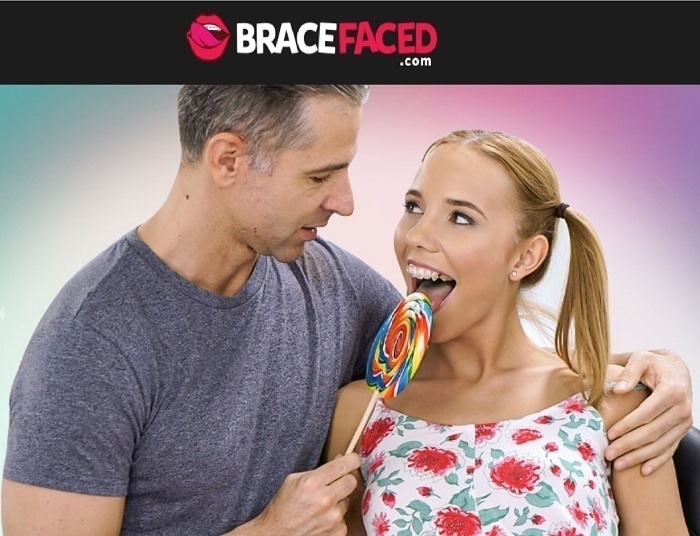 BraceFaced.com – SITERIP image 1